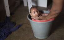 Zika virusas