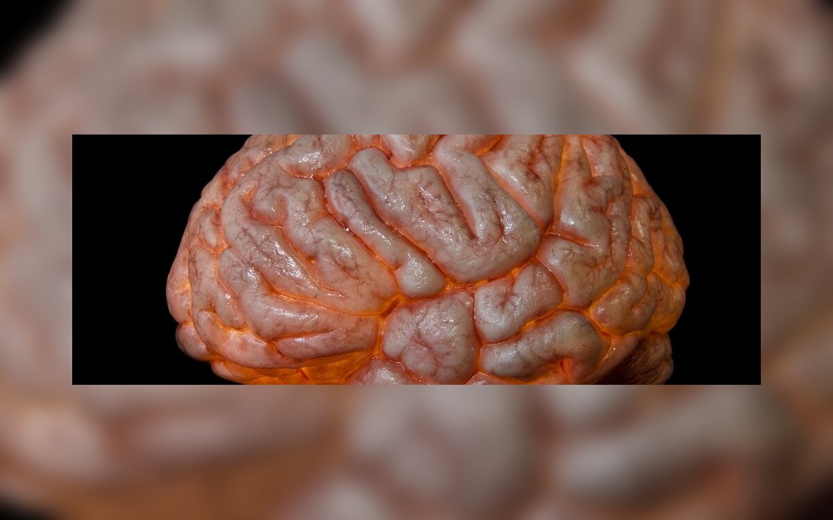 Smegenų kokteilis, MB. skulpturusodas.lt