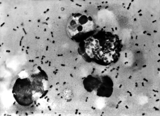 Cholera