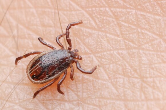 Doctors warn that you can get tick-borne encephalitis and Lyme disease at the same time