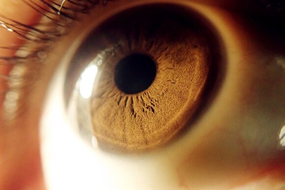 Eye