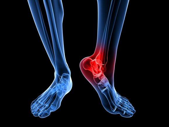 Kojų sąnarių skausmai