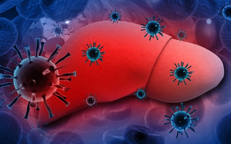 hepatitas