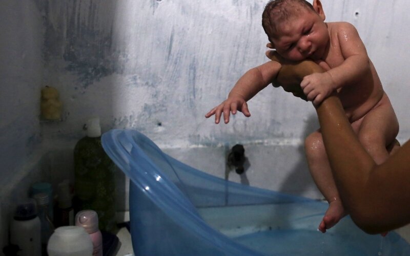 Zika virusas