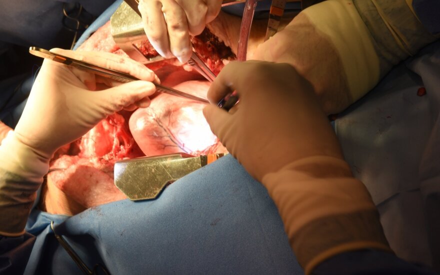 Genetiškai modifikuotos kiaulės širdies persodinimo Davidui Bennettui operacija