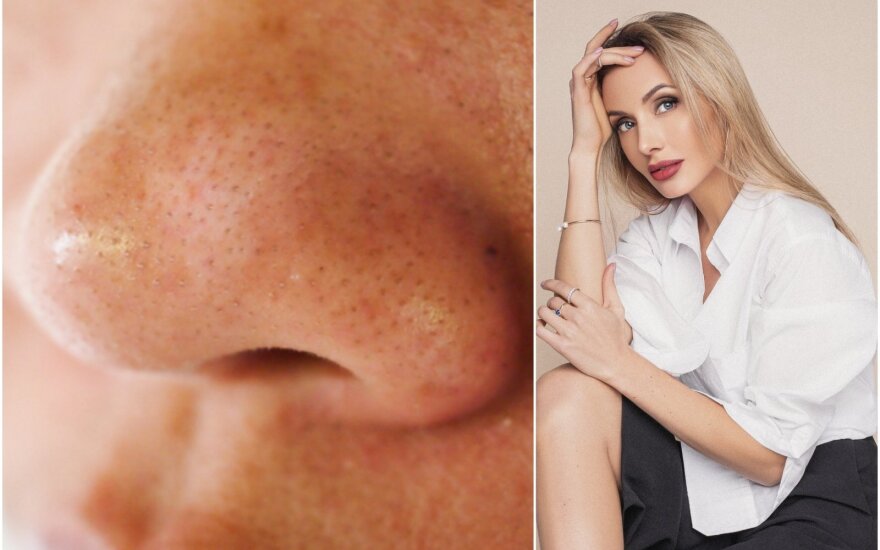 Kaip išvalyti veido poras