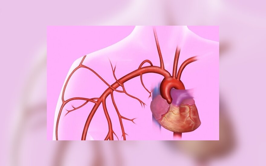 hipertenzija su širdies reumatu
