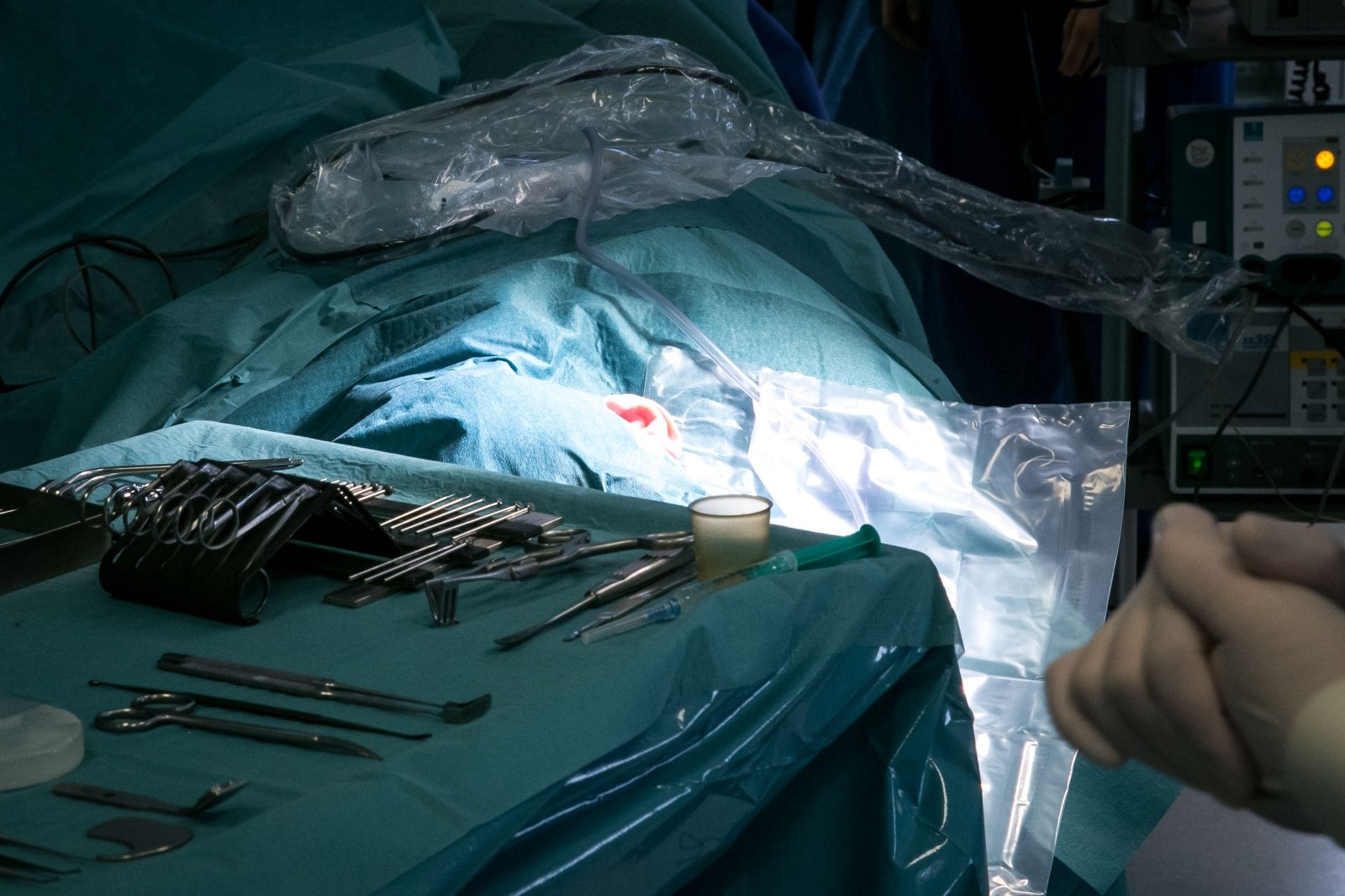 Chirurgai sėkmingai prisiuvo prieš beveik parą nupjautą penį - DELFI Sveikata