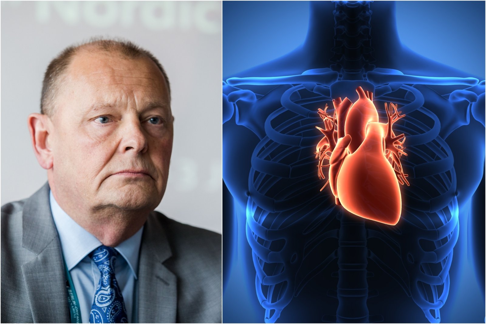 diabetas ir širdies sveikata hipertenzijos simptomų forumas
